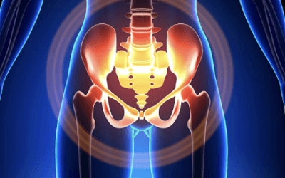 Majeed Pelvic Score: Assessing Pelvic Fracture Outcomes